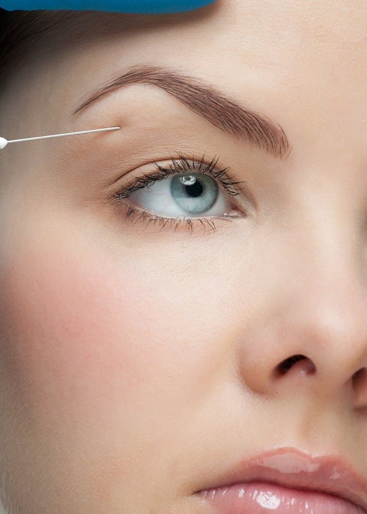 Brow Lift