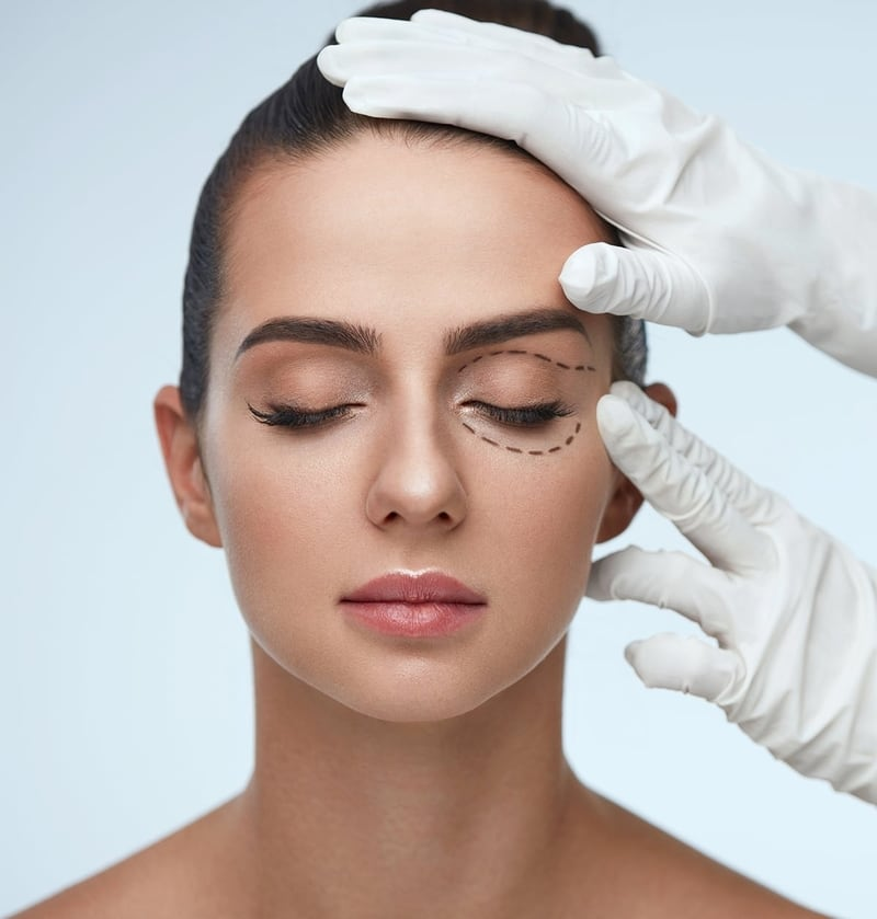 New York Blepharoplasty